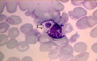 Morula in monosiet